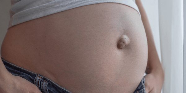 Pregnant with Diastasis Recti, a Hernia and an Active Toddler