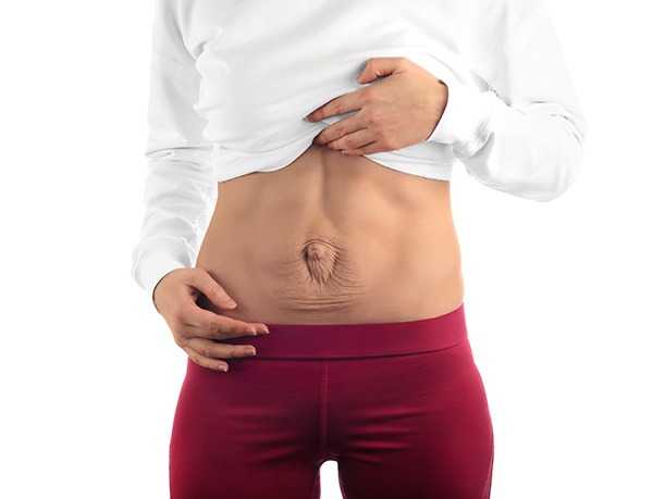 Is Diastasis Recti Preventable?  5 Ways To Prevent Rectus Diastasis - RYC®