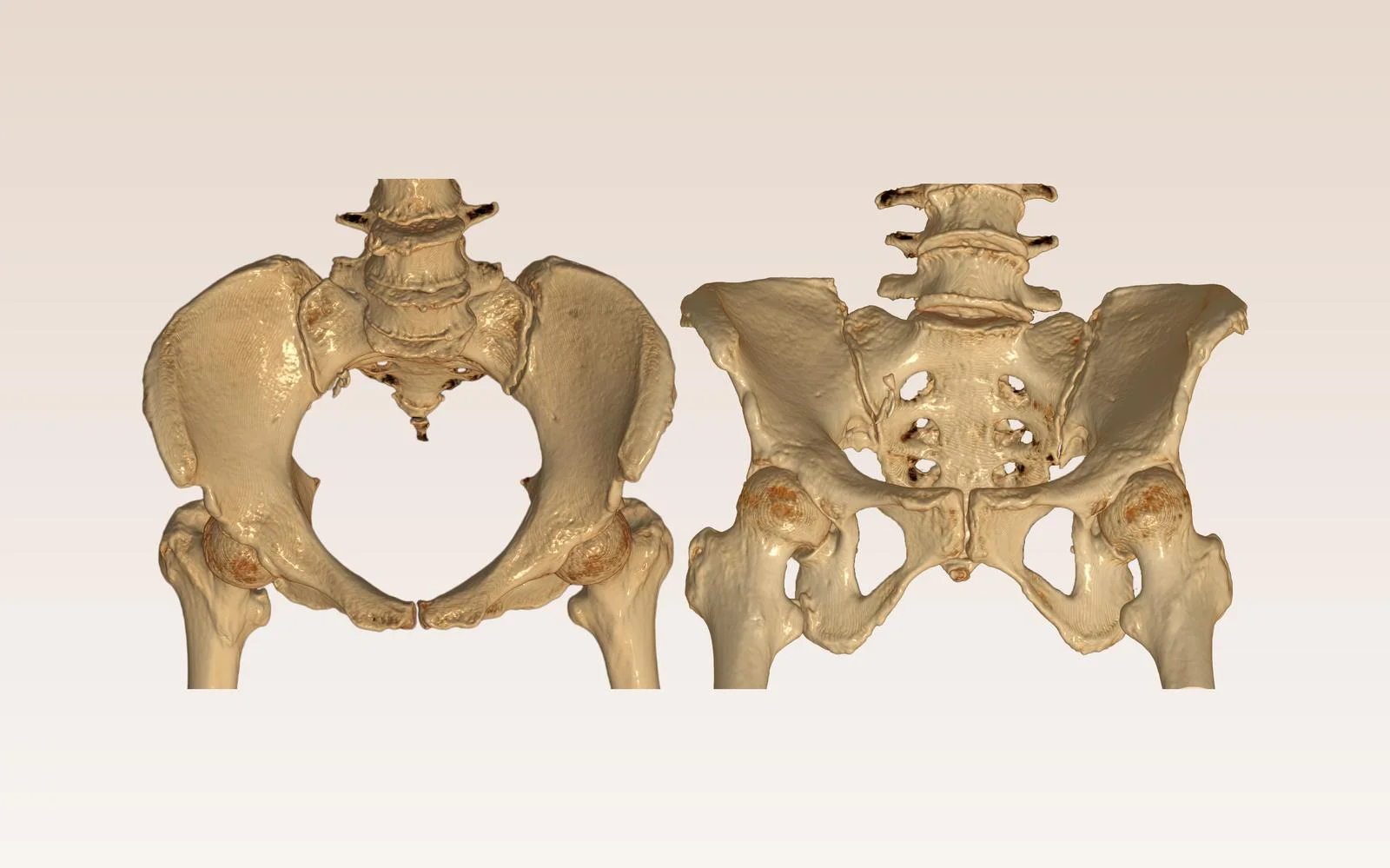 Coccyx